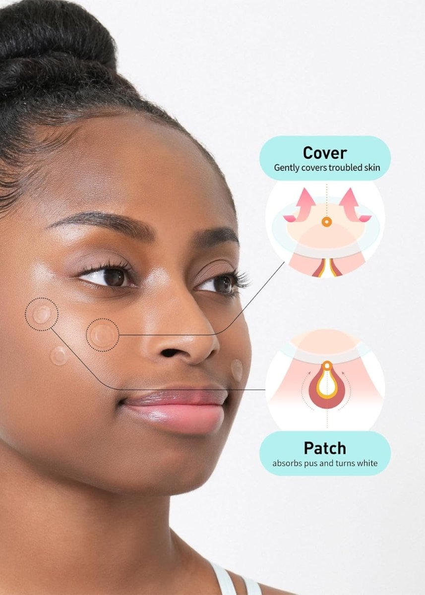 CARE PLUS Spot Patch 15Pcs Health & Beauty oceanbuy beauty markham toronto free ship USA asian korean skincare