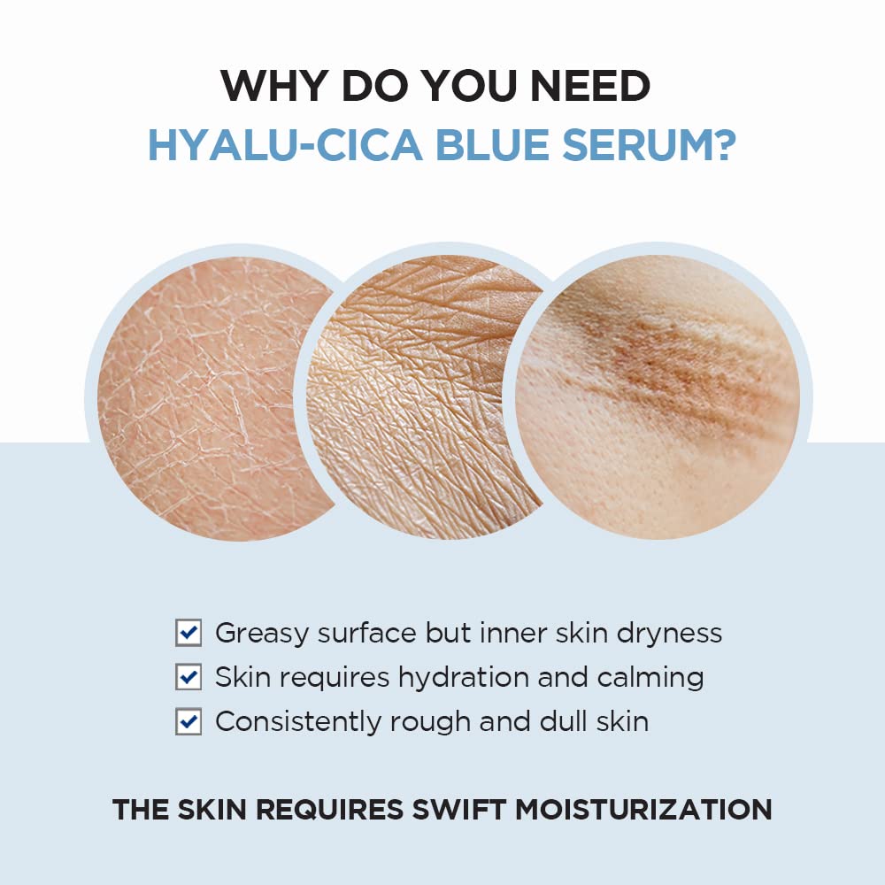 SKIN1004 Madagascar Centella Hyalu - Cica Blue Serum 50ml Health & Beauty oceanbuy.ca markham toronto free ship USA asian korean skincare